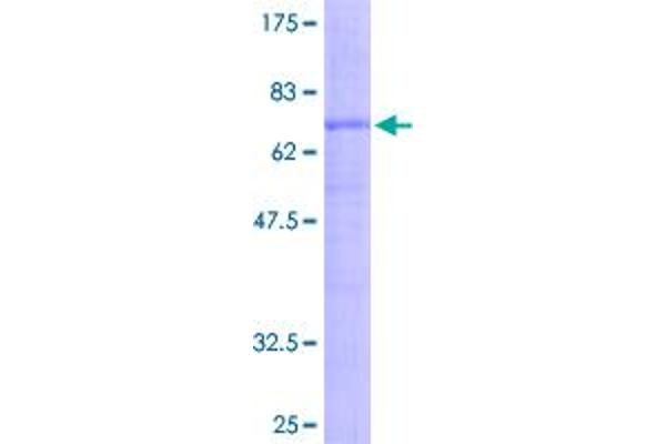 WNT2B Protein (GST tag)