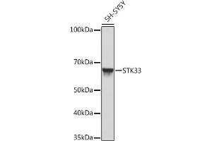 Western blot analysis of extracts of SH-SY5Y cells, using STK33 Rabbit mAb (ABIN7270224) at 1:1000 dilution.