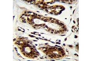 Immunohistochemistry (IHC) image for anti-Nucleolin (NCL) antibody (ABIN3032071)