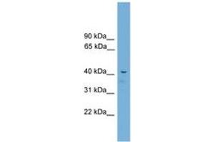 Image no. 1 for anti-Adrenocortical Dysplasia Homolog (ACD) (C-Term) antibody (ABIN6744514) (ACD antibody  (C-Term))