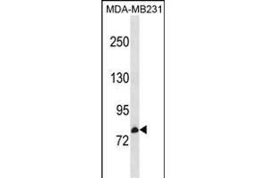 CNNM3 Antibody (Center) (ABIN1881217 and ABIN2838599) western blot analysis in MDA-M cell line lysates (35 μg/lane).
