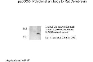 Image no. 1 for anti-Vesicle-Associated Membrane Protein 3 (VAMP3) (N-Term) antibody (ABIN347006) (VAMP3 antibody  (N-Term))