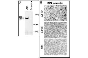 A) Rat B50 brain tumor cell extracts were immunoprecipitated with RIZ1 antibody (cat (ABIN388010 and ABIN2845353)) or preimmune (ref. (PRDM2 antibody  (AA 245-573))