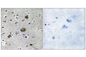 Immunohistochemistry (IHC) image for anti-A Kinase (PRKA) Anchor Protein 1 (AKAP1) (Internal Region) antibody (ABIN1849849) (AKAP1 antibody  (Internal Region))