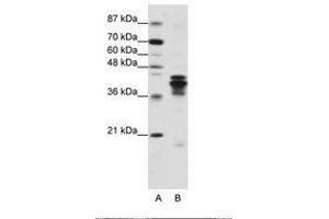 Image no. 2 for anti-Heterogeneous Nuclear Ribonucleoprotein D (HNRNPD) (C-Term) antibody (ABIN203266) (HNRNPD/AUF1 antibody  (C-Term))