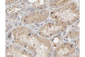ABIN6267474 at 1/200 staining human kidney tissue sections by IHC-P. (AKT1 antibody  (pSer473))