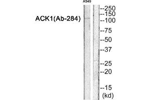 Western Blotting (WB) image for anti-tyrosine Kinase, Non-Receptor, 2 (TNK2) (Tyr284) antibody (ABIN1847979) (TNK2 antibody  (Tyr284))