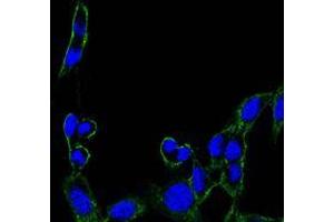Immunofluorescence analysis of B16 cells using FAK mouse mAb (green). (FAK antibody)