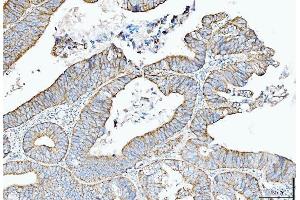 IHC analysis of Cytokeratin 5 using anti-Cytokeratin 5 antibody (ABIN7602992).