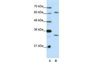 Western Blotting (WB) image for anti-AU RNA Binding Protein/enoyl-CoA Hydratase (AUH) antibody (ABIN2462112) (AUH antibody)