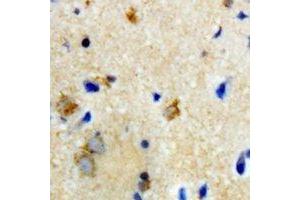 Immunohistochemical analysis of Biotinidase staining in rat brain formalin fixed paraffin embedded tissue section. (BTD antibody)