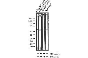 Western blot analysis of Phospho-GABA-RB (Ser434) expression in various lysates (GABA-RB (pSer434) antibody)