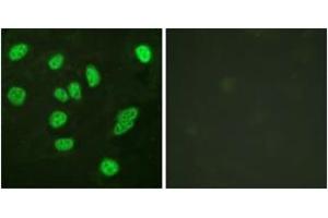 Immunofluorescence analysis of HeLa cells, using B-Myb (Ab-577/581) Antibody. (MYBL2 antibody  (AA 551-600))
