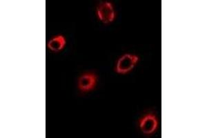 Immunofluorescent analysis of PCMT1 staining in Hela cells.