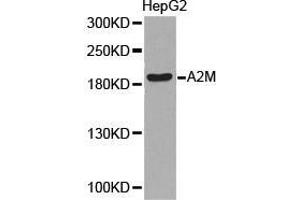 Western Blotting (WB) image for anti-alpha-2-Macroglobulin (A2M) antibody (ABIN1870709) (alpha 2 Macroglobulin antibody)