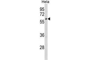 Western blot analysis of CYP7B1 Antibody (Center) in Hela cell line lysates (35ug/lane).