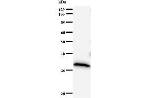 Western Blotting (WB) image for anti-DNA (Cytosine-5-)-Methyltransferase 3 beta (DNMT3B) antibody (ABIN933161) (DNMT3B antibody)