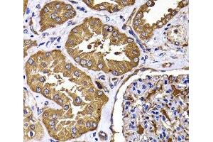 Immunohistochemistry of paraffin-embedded Human kidney using TGS1 Polyclonal Antibody at dilution of 1:100 (40x lens). (TGS1 antibody)