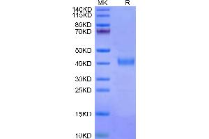 Cynomolgus IL-2 R beta on Tris-Bis PAGE under reduced conditions. (IL2 Receptor beta Protein (AA 27-239) (His tag))