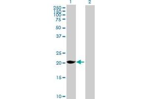 Western Blot analysis of MAGEH1 expression in transfected 293T cell line by MAGEH1 MaxPab polyclonal antibody. (MAGEH1 antibody  (AA 1-219))