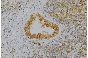 ABIN6277560 at 1/100 staining Human uterus tissue by IHC-P. (WIF1 antibody  (Internal Region))