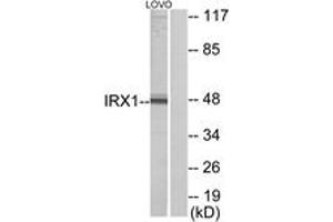 Western blot analysis of extracts from LOVO cells, using IRX1 Antibody. (IRX1 antibody  (AA 221-270))