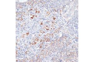 Immunohistochemistry of paraffin-embedded rat ovary using SMPD1 antibody. (SMPD1 antibody  (AA 70-340))