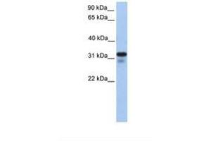 Image no. 1 for anti-Heparan Sulfate (Glucosamine) 3-O-Sulfotransferase 6 (HS3ST6) (AA 218-267) antibody (ABIN6739228) (Heparan Sulfate (Glucosamine) 3-O-Sulfotransferase 6 (HS3ST6) (AA 218-267) antibody)