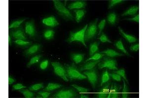 Immunofluorescence of monoclonal antibody to MKNK1 on HeLa cell. (MKNK1 antibody  (AA 1-465))