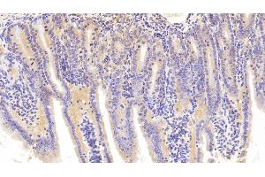 Immunohistochemistry (IHC) image for anti-phosphoenolpyruvate Carboxykinase 1 (Soluble) (PCK1) (AA 312-563) antibody (ABIN7432913)