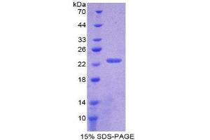 SDS-PAGE (SDS) image for Collagen, Type VI, alpha 1 (COL6A1) (AA 828-1022) protein (His tag) (ABIN1079236) (COL6A1 Protein (AA 828-1022) (His tag))