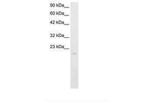 Image no. 1 for anti-SP140 Nuclear Body Protein (SP140) (AA 39-88) antibody (ABIN202038) (SP140 antibody  (AA 39-88))