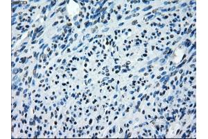 Immunohistochemical staining of paraffin-embedded endometrium tissue using anti-SATB1mouse monoclonal antibody. (SATB1 antibody)