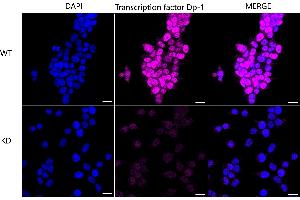 anti-Transcription Factor Dp-1 (TFDP1) antibody