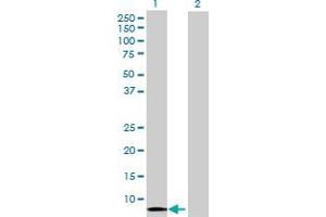 Lane 1: HCP5 transfected lysate ( 14.