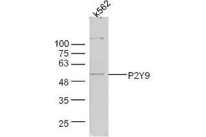 Human k562 lysates probed with Rabbit Anti-P2Y9 Polyclonal Antibody, Unconjugated  at 1:300 overnight at 4˚C. (LPAR4 antibody  (AA 175-270))