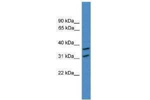WB Suggested Anti-OTUD6A Antibody Titration: 0. (OTUD6A antibody  (N-Term))