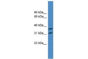 WB Suggested Anti-OTUD6A Antibody Titration: 0. (OTUD6A antibody  (N-Term))