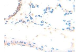 Detection of ADPN in Rat Lung Tissue using Polyclonal Antibody to Adiponectin (ADPN) (ADIPOQ antibody  (AA 111-244))