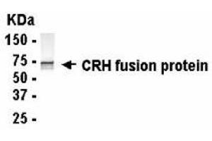Western Blotting (WB) image for anti-Corticotropin Releasing Hormone (CRH) (AA 27-196) antibody (ABIN2467797) (CRH antibody  (AA 27-196))