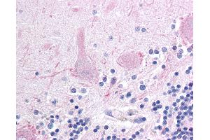 Anti-AFF1 antibody IHC of human brain, cerebellum. (AF4 antibody  (AA 1190-1203))