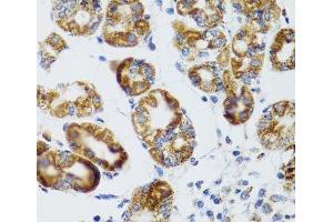 Immunohistochemistry of paraffin-embedded Human stomach using RIPK4 Polyclonal Antibody at dilution of 1:100 (40x lens). (RIPK4 antibody)