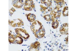 Immunohistochemistry of paraffin-embedded Human stomach using RIPK4 Polyclonal Antibody at dilution of 1:100 (40x lens).