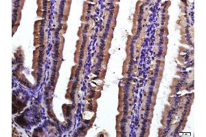 Paraformaldehyde-fixed, paraffin embedded mouse intestine, Antigen retrieval by boiling in sodium citrate buffer (pH6. (CD9 antibody  (AA 101-200))