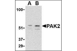 Western blot analysis of PAK2 in Jurkat lysate with this product at (A) 0. (PAK2 antibody  (C-Term))