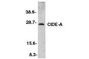 Western blot analysis of CIDE-A in murine heart tissue lysate with CIDE-A antibody at 2ug/ml. (CIDEA antibody  (AA 200-214))