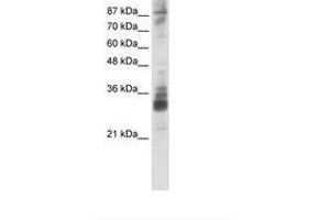 Image no. 1 for anti-RNA (Guanine-9-) Methyltransferase Domain Containing 2 (RG9MTD2) (AA 181-230) antibody (ABIN202281) (RG9MTD2 antibody  (AA 181-230))