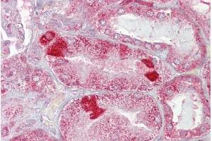 Immunohistochemistry with Kidney tissue at an antibody concentration of 5µg/ml using anti-AMACR antibody (ARP60806_P050) (AMACR antibody  (C-Term))