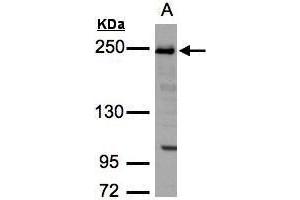 WB Image Sample(30 ug whole cell lysate) A:H1299 5% SDS PAGE antibody diluted at 1:3000 (TJP1 antibody  (N-Term))