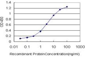 Detection limit for recombinant GST tagged GRK4 is approximately 0. (GRK4 antibody  (AA 36-145))